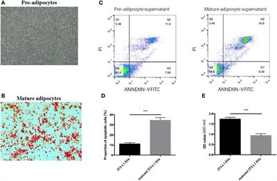 Adipocytes-Derived Extracellular Vesicle-miR-26b Promotes Apoptosis of Cumulus Cells and Induces Polycystic Ovary Syndrome